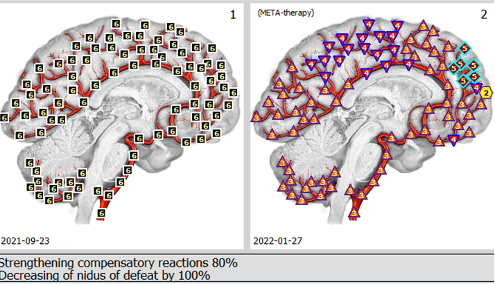 BioResonance used to measure the frequency of energy wavelengths coming from the body. This forms the basis of diagnosis and treatment. imbalance